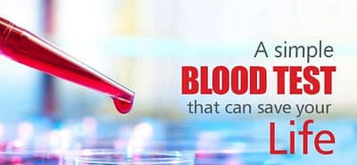 Essential Blood Test: What You Have To Know