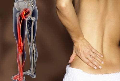 Lower Back Pain & Sciatica (Leg Pain)